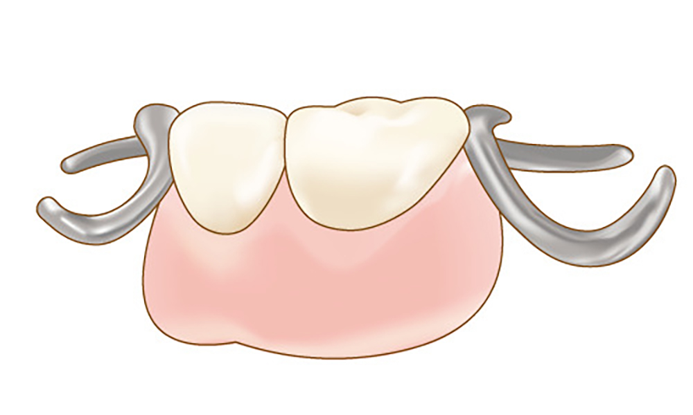 保険適用の場合
