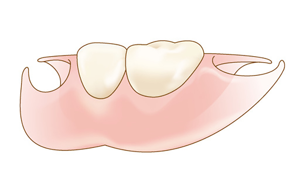 保険適用外の場合