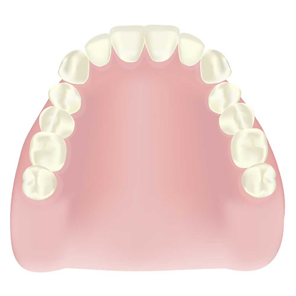 保険適用の場合