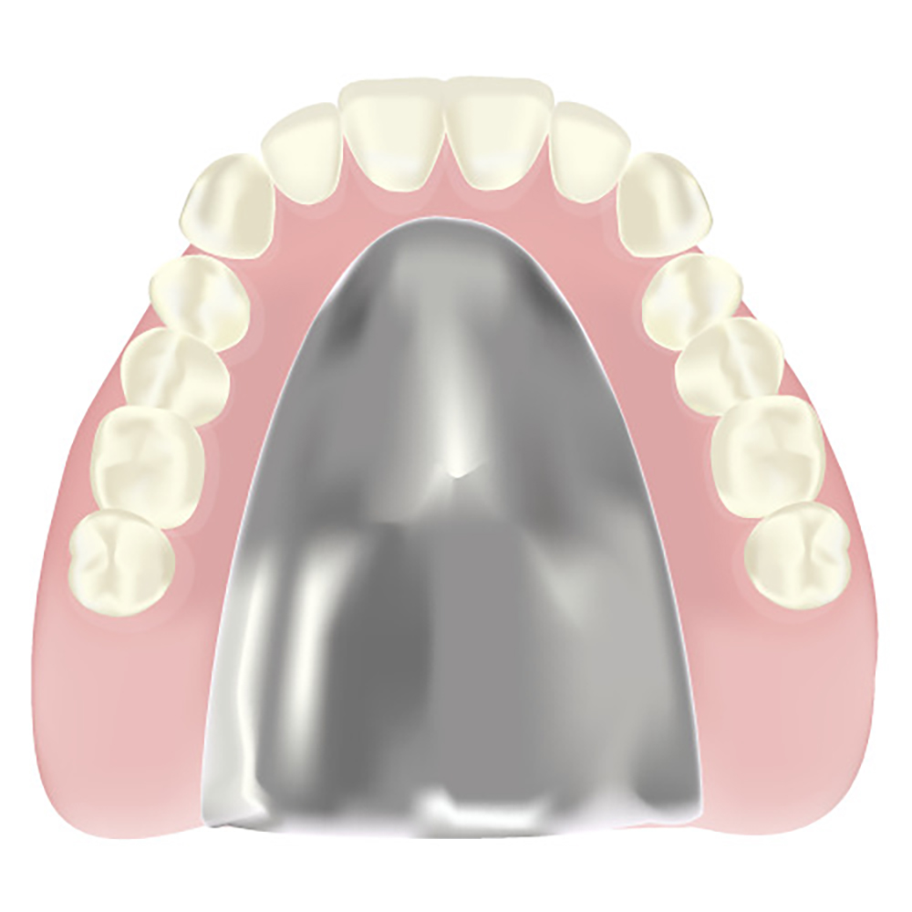 保険適用外の場合