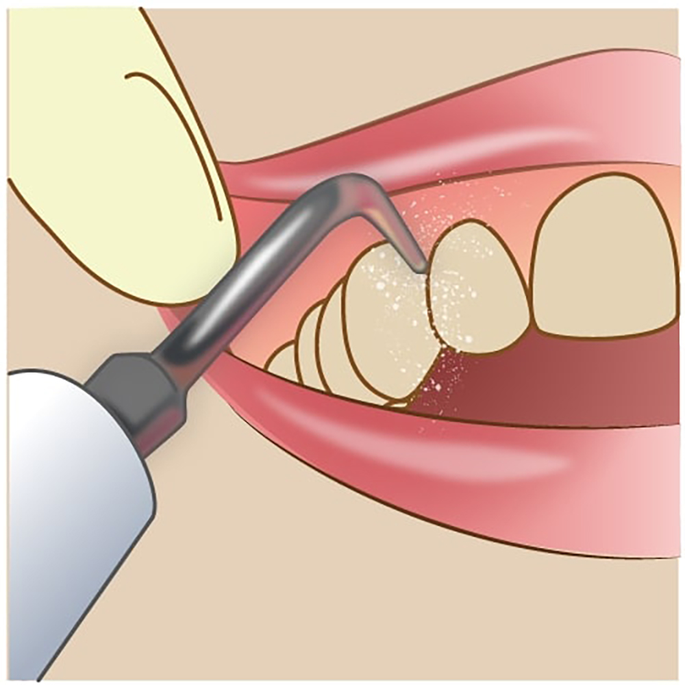 プロフェッショナルケアとセルフケア