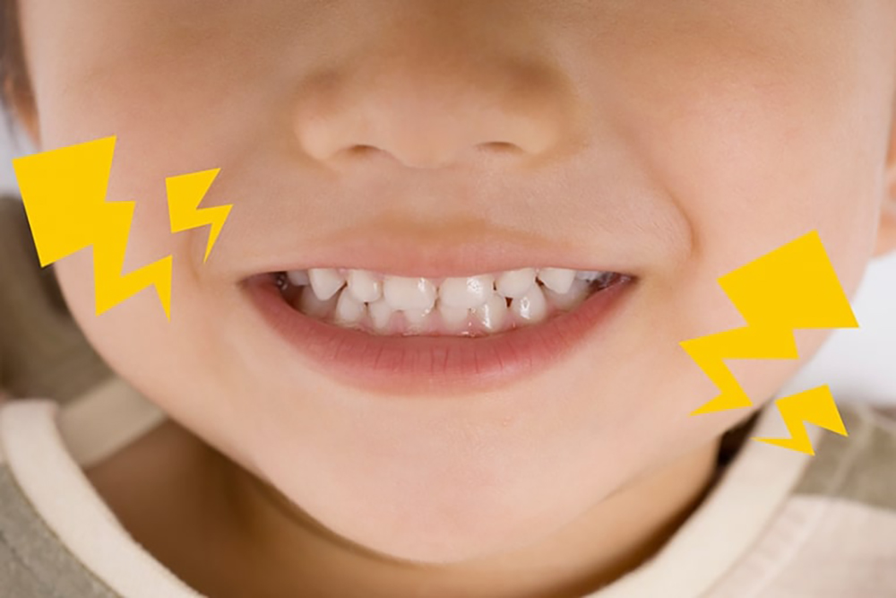 マウスピースも保険診療で作れます