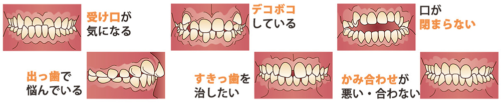 どのような歯並びでお悩みですか