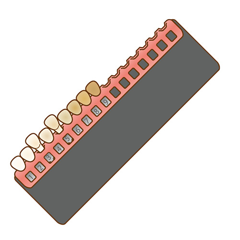 治療前の歯の色をチェック